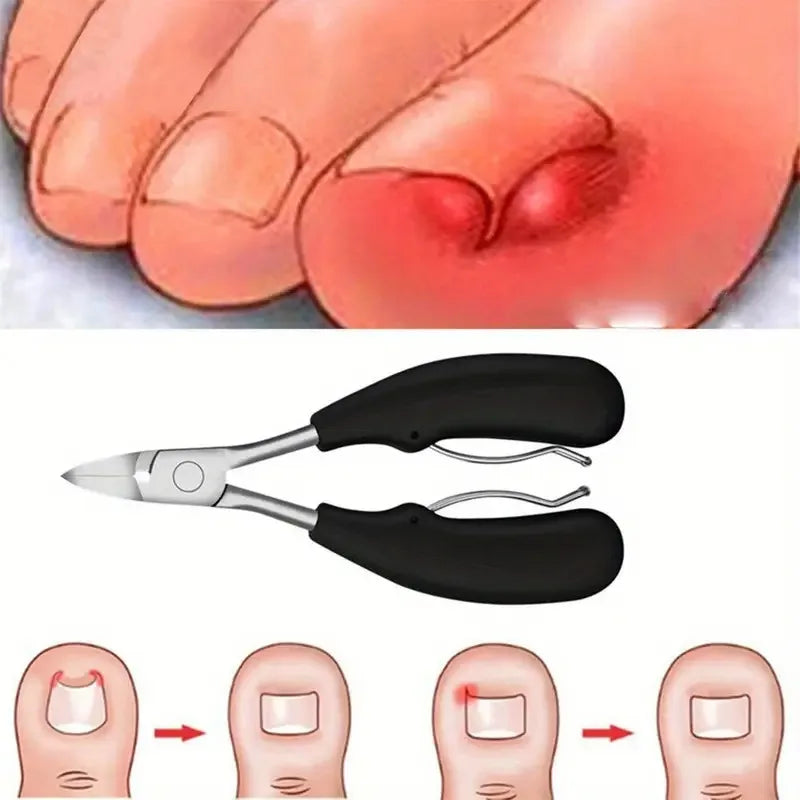 4pcs Ingrown Toenail Clipper Set for Thick Nails - Heavy-Duty Podiatrist Grade, Stainless Steel Blades with Easy Grip Handle - P